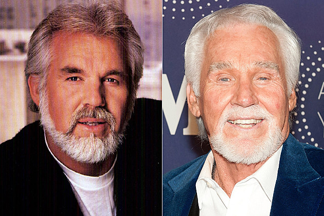 kenny-rogers-plastic-surgery kenny-rogers-plastic-surgery