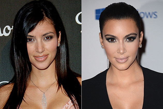 Kim Kardashian's plastic surgery, before and after Kim Kardashian's plastic surgery, before and after